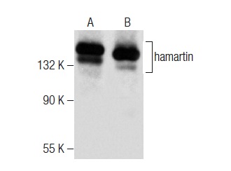  hamartin (E-7): sc-377387. Western blot analysis of hamartin expression in SJRH30 (A) and IMR-32 (B) whole cell lysates.