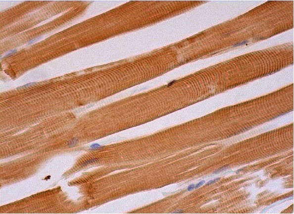  hamartin (E-7): sc-377387. Immunoperoxidase staining of formalin fixed, paraffin-embedded human skeletal muscle tissue showing cytoplasmic staining of myocytes.