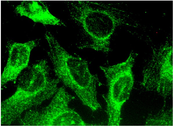  hamartin (E-7): sc-377387. Immunofluorescence staining of methanol-fixed HeLa cells showing cytoplasmic and membrane localization.