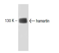  hamartin (18): sc-136436. Western blot analysis of hamartin expression in WI-38 whole cell lysate.