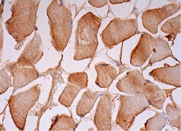  hamartin (E-20): sc-12080. Immunoperoxidase staining of formalin fixed, paraffin-embedded human skeletal muscle tissue showing membrane and cytoplasmic staining of myocytes.