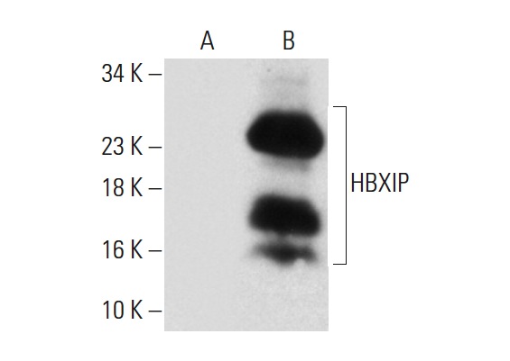  HBXIP (FL-91): sc-134791. Western blot analysis of HBXIP expression in non-transfected: sc-117752 (A) and human HBXIP transfected: sc-116745 (B) 293T whole cell lysates.