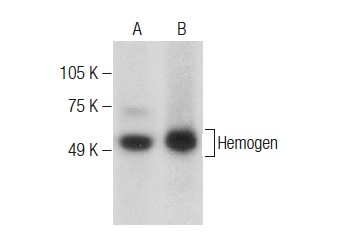  Hemogen (G-2): sc-377438. Western blot analysis of Hemogen expression in LADMAC whole cell lysate (A) and MCP-5 nuclear extract (B).