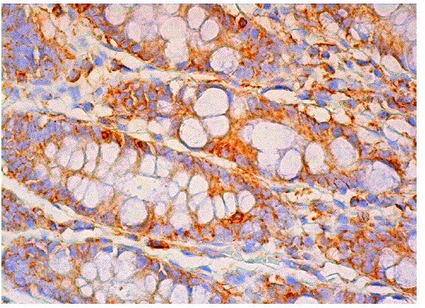  ICAD<sub>L</sub> (C-4): sc-376044. Immunoperoxidase staining of formalin fixed, paraffin-embedded human rectum tissue showing cytoplasmic staining of glandular cells.