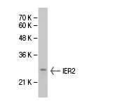  IER2 (E-19): sc-101980. Western blot analysis of IER2 expression in Hep G2 whole cell lysate.