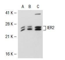  IER2 (E-19): sc-101980. Western blot analysis of IER2 expression in non-transfected 293T: sc-117752 (A), human IER2 transfected 293T: sc-117448 (B) and Hep G2 (C) whole cell lysates.