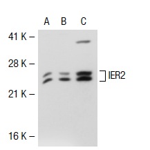  IER2 (E-19): sc-101980. Western blot analysis of IER2 expression in non-transfected 293T: sc-117752 (A), human IER2 transfected 293T: sc-111654 (B) and Hep G2 (C) whole cell lysates.