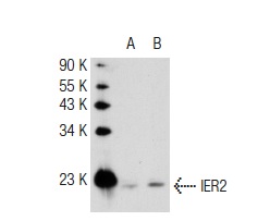  IER2 (E-19): sc-101980. Western blot analysis of IER2 expression in non-transfected: sc-117752 (A) and human IER2 transfected: sc-172808 (B) 293T whole cell lysates.