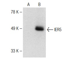  IER5 (C-14): sc-162955. Western blot analysis of IER5 expression in non-transfected: sc-117752 (A) and human IER5 transfected: sc-111703 (B) 293T whole cell lysates.