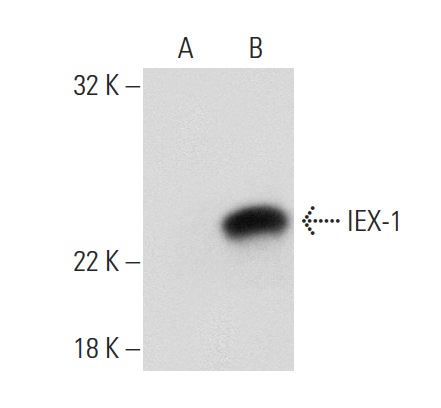  IEX-1 (C-20): sc-8454. Western blot analysis of IEX-1 expression in non-transfected: sc-117752 (A) and human IEX-1 transfected: sc-110039 (B) 293T whole cell lysates.