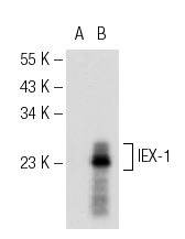  IEX-1 (M-20): sc-8457. Western blot analysis of IEX-1 expression in non-transfected: sc-117752 (A) and mouse IEX-1 transfected: sc-120948 (B) 293T whole cell lysates.