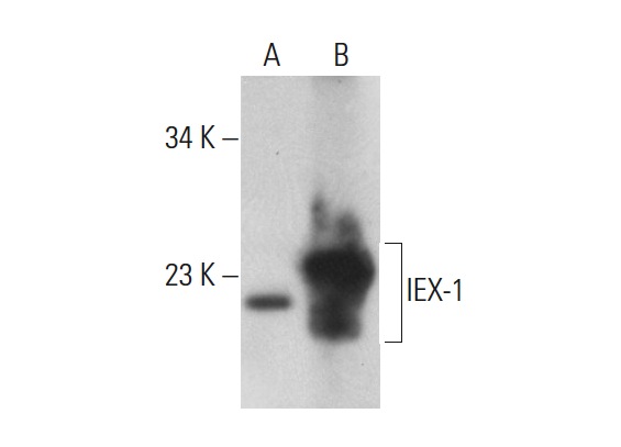  IEX-1 (M-20): sc-8457. Western blot analysis of IEX-1 expression in non-transfected: sc-117752 (A) and mouse IEX-1 transfected: sc-110242 (B) 293T whole cell lysates.