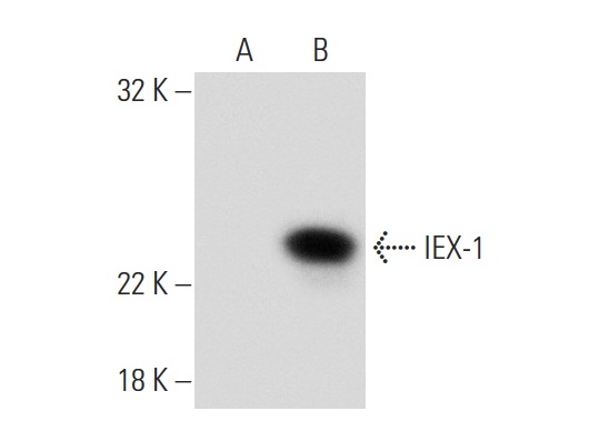  IEX-1 (M-20): sc-8457. Western blot analysis of IEX-1 expression in non-transfected: sc-117752 (A) and human IEX-1 transfected: sc-110039 (B) 293T whole cell lysates.