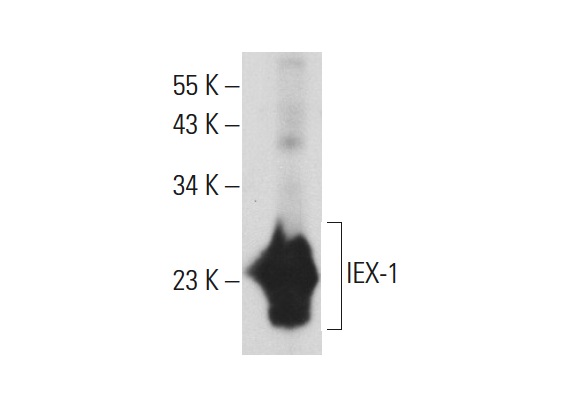  IEX-1 (FL-156): sc-33171. Western blot analysis of IEX-1 expression in C32 whole cell lysate.