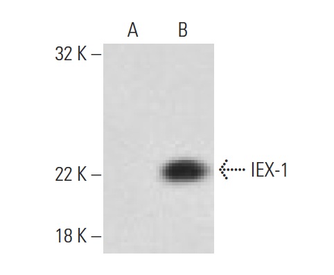  IEX-1 (N-17): sc-8453. Western blot analysis of IEX-1 expression in non-transfected: sc-117752 (A) and human IEX-1 transfected: sc-110039 (B) 293T whole cell lysates.