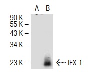  IEX-1 <sub>S/L</sub> (H-20): sc-8456. Western blot analysis of IEX-1 expression in non-transfected: sc-117752 (A) and mouse IEX-1 transfected: sc-120948 (B) 293T whole cell lysates.