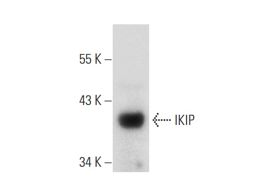  IKIP (K-12): sc-161733. Western blot analysis of IKIP expression in mouse skeletal muscle tissue extract.