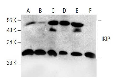  IKIP (K-12): sc-161733. Western blot analysis of IKIP expression in HeLa (A), HEK293 (B), ECV304 (C), HUV-EC-C (D), A549 (E) and Jurkat (F) whole cell lysates.