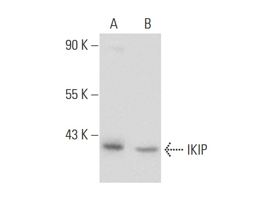  IKIP (K-12): sc-161733. Western blot analysis of IKIP expression in LADMAC (A) and KNRK (B) whole cell lysates.