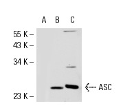  ASC (N-15)-R: sc-22514-R. Western blot analysis of ASC expression in non-transfected 293T: sc-117752 (A), mouse ASC transfected 293T: sc-126449 (B) and HL-60 (C) whole cell lysates.