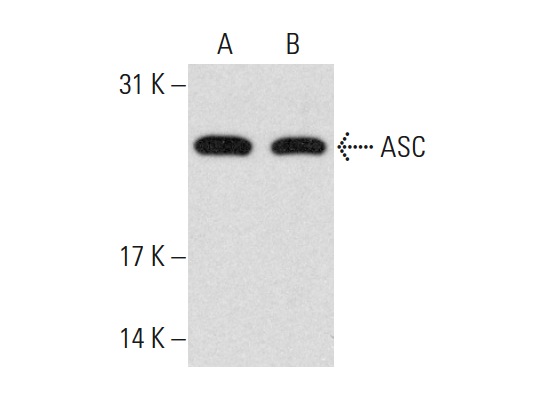  ASC (N-15)-R: sc-22514-R. Western blot analysis of ASC expression in HL-60 (A) and SK-MEL-28 (B) whole cell lysates.