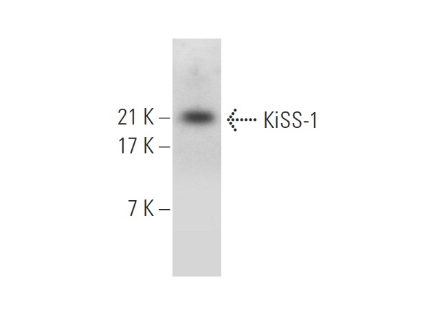  KiSS-1 (C-20): sc-18134. Western blot analysis of KiSS-1 expression in mouse testis tissue extract.