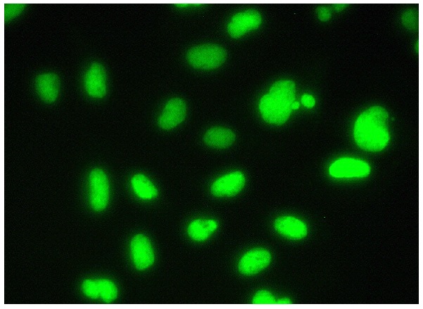  Ku-86 (B-1): sc-5280. Immunofluorescence staining of formalin-fixed HeLa cells showing nuclear localization. Kindly provided by Yang Xiang, Ph.D., Division of Newborn Medicine, Boston Childrens Hospital, Cell Biology Department, Harvard Medical School.