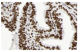  Ku-86 (B-1): sc-5280. Immunoperoxidase staining of formalin fixed, paraffin-embedded human fallopian tube tissue showing nuclear staining of glandular cells. Kindly provided by The Swedish Human Protein Atlas (HPA) program.