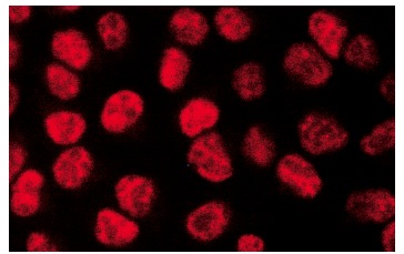  Ku-86 (B-1): sc-5280. Immunofluorescence staining of methanol-fixed HeLa cells showing nuclear localization.