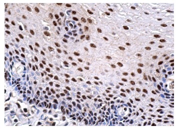  Ku-86 (B-1): sc-5280. Immunoperoxidase staining of formalin fixed, paraffin-embedded human esophagus tissue showing nuclear staining of squamous epithelial cells.