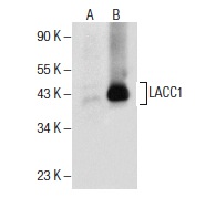  LACC1 (E-12): sc-376231. Western blot analysis of LACC1 expression in non-transfected: sc-117752 (A) and human LACC1 transfected: sc-115440 (B) 293T whole cell lysates.