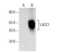  LACC1 (H-6): sc-376064. Western blot analysis of LACC1 expression in non-transfected: sc-117752 (A) and human LACC1 transfected: sc-115440 (B) 293T whole cell lysates.