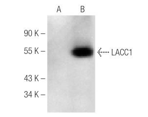  LACC1 (E-7): sc-374553. Western blot analysis of LACC1 expression in non-transfected: sc-117752 (A) and human LACC1 transfected: sc-115440 (B) 293T whole cell lysates.