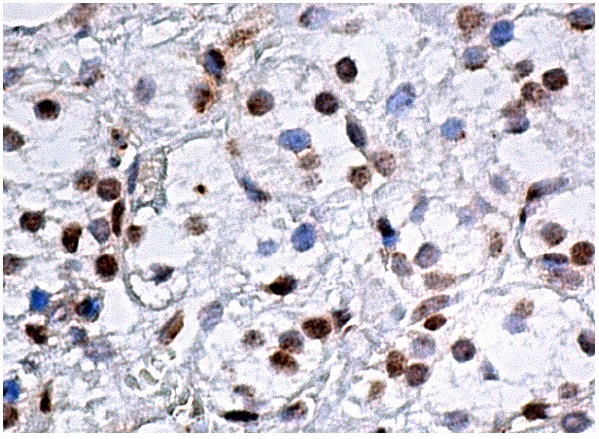  LACC1 (E-7): sc-374553. Immunoperoxidase staining of formalin fixed, paraffin-embedded human adrenal gland tissue showing nuclear staining of glandular cells.