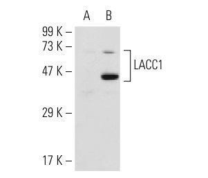  LACC1 (K-15): sc-84033. Western blot analysis of LACC1 expression in non-transfected: sc-117752 (A) and human LACC1 transfected: sc-115440 (B) 293T whole cell lysates.