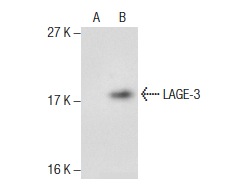  LAGE-3 (P-19): sc-243234. Western blot analysis of LAGE-3 expression in non-transfected: sc-117752 (A) and mouse LAGE-3 transfected: sc-121277 (B) 293T whole cell lysates.