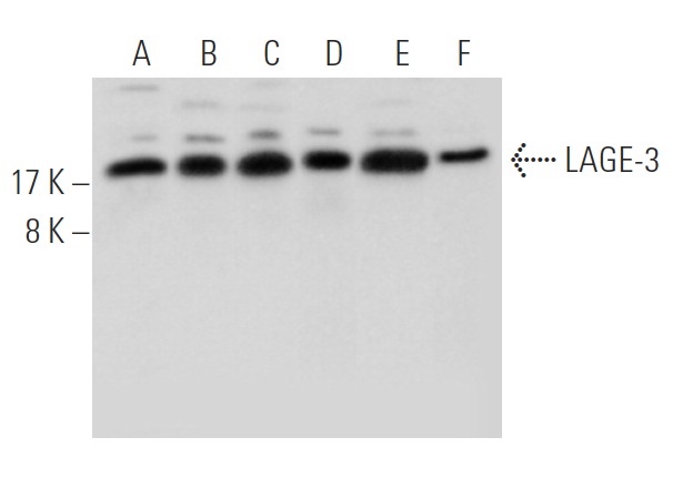  LAGE-3 (Q-16): sc-243233. Western blot analysis of LAGE-3 expression in mouse testis (A) and mouse heart (B) tissue extracts, PC-12 (C) and mouse PBL (D) whole cell lysates and KNRK (E) and WEHI-231 (F) nuclear extracts.