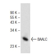  BAALC (C-2): sc-365516. Western blot analysis of BAALC expression in CCRF-CEM whole cell lysate.