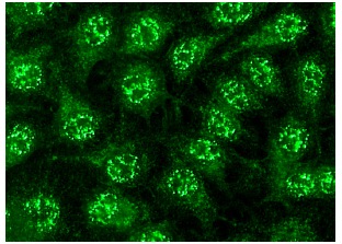  BAALC (C-2): sc-365516. Immunofluorescence staining of methanol-fixed HeLa cells showing nuclear and membrane localization.