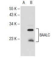  BAALC (E-18): sc-70021. Western blot analysis of BAALC expression in non-transfected: sc-117752 (A) and human BAALC transfected: sc-170308 (B) 293T whole cell lysates.