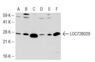  LOC728029 (C-15): sc-83687. Western blot analysis of LOC728029 expression in HEK293 (A), HeLa (B), IMR-32 (C), Hep G2 (D), SW480 (E) and K-562 (F) whole cell lysates.