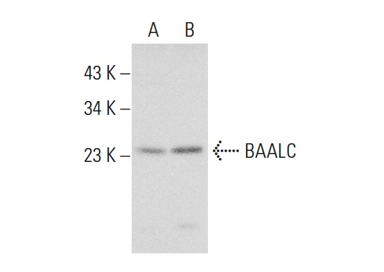  BAALC (E-18): sc-70021. Western blot analysis of BAALC expression in Jurkat (A) and CCRF-CEM (B) whole cell lysates.