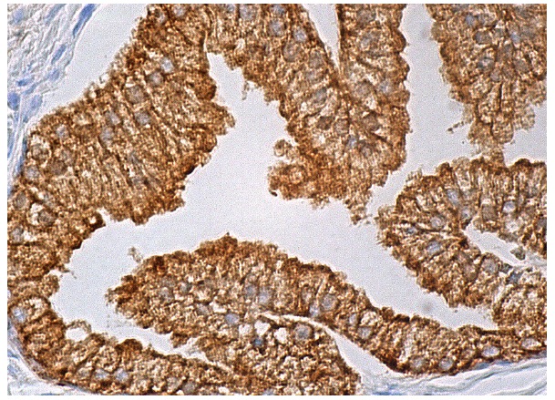  Mac-2BP (E-8): sc-374541. Immunoperoxidase staining of formalin fixed, paraffin-embedded human prostate tissue showing cytoplasmic and membrane staining of glandular cells.