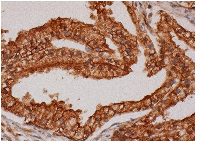  Mac-2BP (H-300): sc-98706. Immunoperoxidase staining of formalin fixed, paraffin-embedded human prostate tissue showing cytoplasmic and membrane staining of glandular cells.