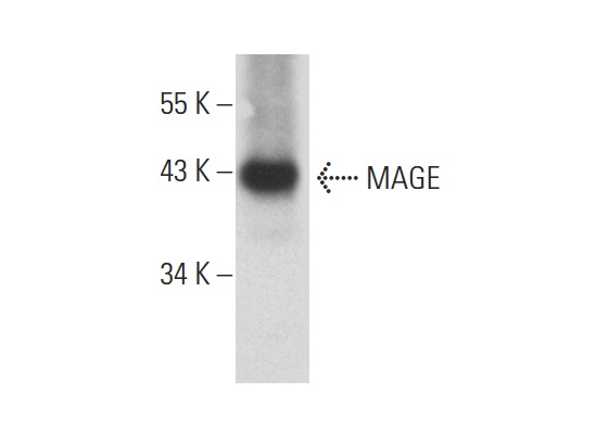  MAGE (B-5): sc-365150. Western blot analysis of MAGE expression in Hs 294T whole cell lysate.