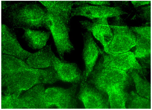  MAGE (B-5): sc-365150. Immunofluorescence staining of formalin-fixed HepG2 cells showing cytoplasmic and nuclear localization.