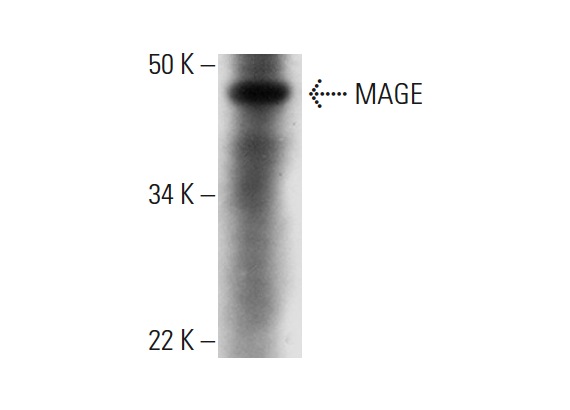  MAGE (E-8): sc-393083. Western blot analysis of MAGE expression in Hs 294T whole cell lysate.