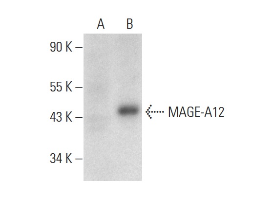  MAGE (F-1): sc-398986. Western blot analysis of MAGE-A12 expression in non-transfected: sc-110760 (A) and human MAGE-A12 transfected: sc-110824 (B) 293 whole cell lysates.