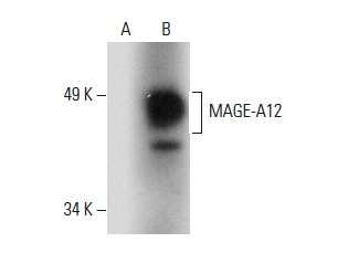  MAGE (F-4): sc-390509. Western blot analysis of MAGE expression in non-transfected: sc-110760 (A) and human MAGE-A12 transfected: sc-110824 (B) 293 whole cell lysates.