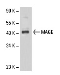  MAGE (6A111): sc-71537. Western blot analysis of MAGE expression in SK-MEL-28 whole cell lysate.